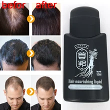 Chinese Anti hair loss Liquid 50ml prevent hair loss hair nourishing liquid in oil control sunburst
