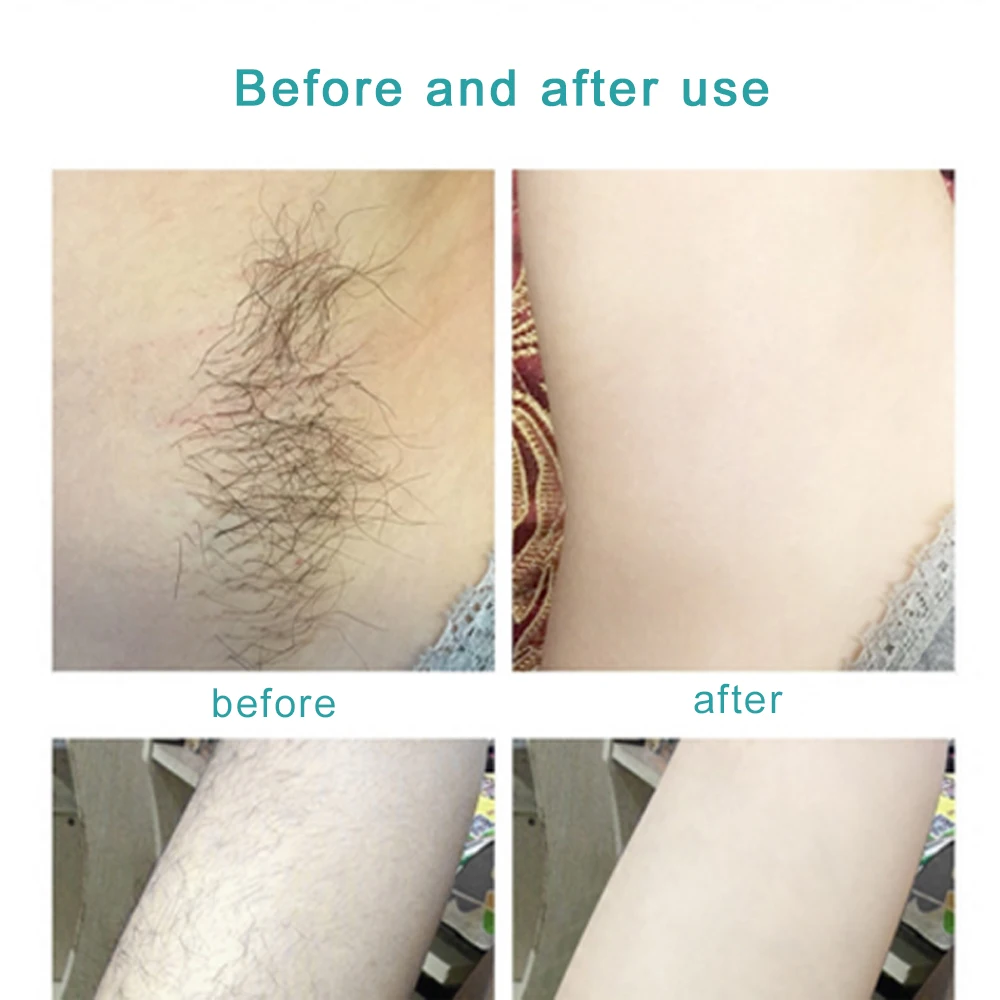 IPL постоянный лазер для удаления волос Эпилятор эпиляционный лазер эпилятор для женщин и мужчин лица подмышки бикини ноги бороды