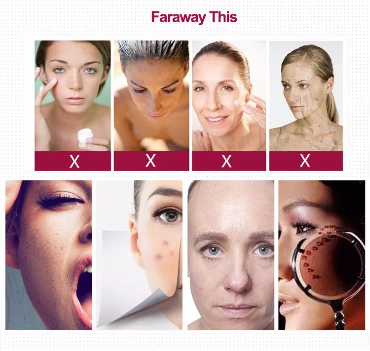 PJ038-derma-roller_04