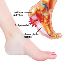 2PCS Protective Silicone PLANTAR FASCIITIS Heel Spur Ankle Gel Support Pain Relief Moisturizing Gel Heel Socks