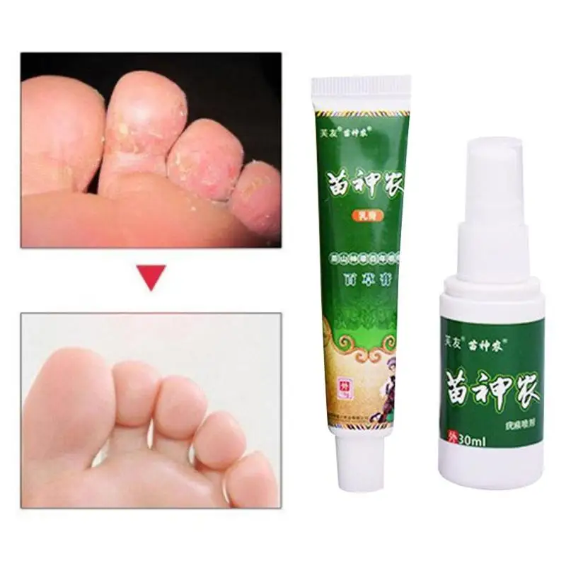 

Eczema Dermatitis Prutitus Treatment+Reproductive Skin Herpes Corn Spray 15g+30ml With Box Chinese Medicine Skin Problems