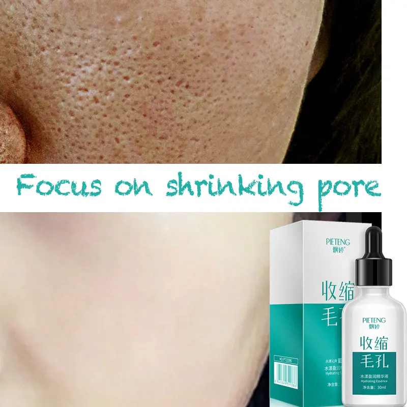 

Shrinking pore Face serum facial retinol suero visage moisturizing shrinkage pore essence skin care ciracle essencia