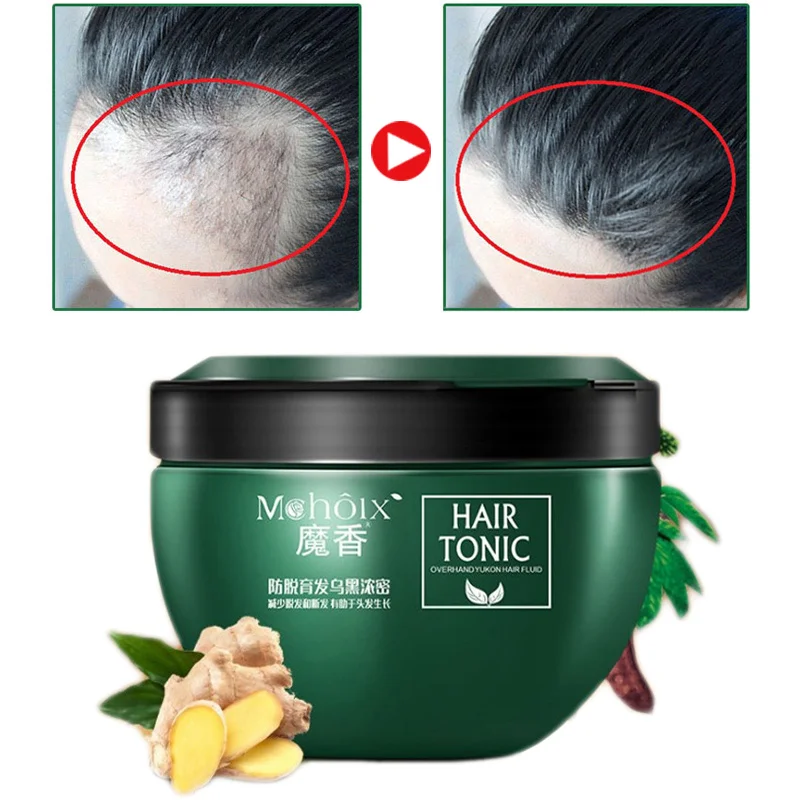 300g Men Women Hair Loss Treatment Hair Regrowth Treatment Tonic Cream