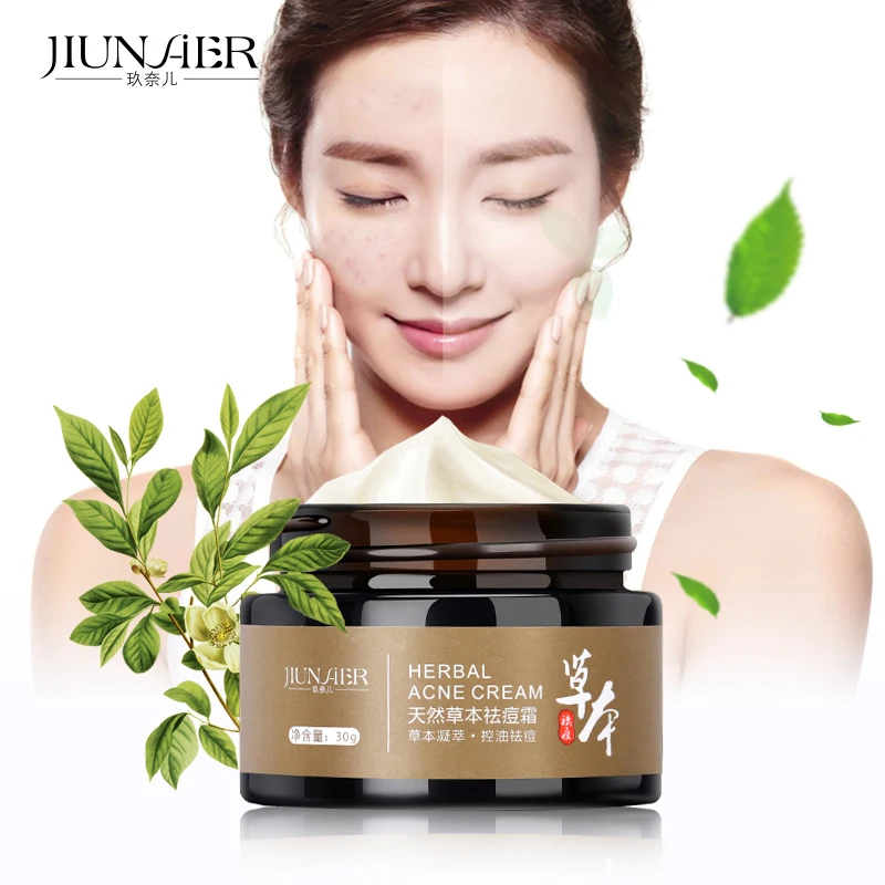 Herbal Acne Cream Skin Care Natural Herbs Get Rid Of Acne Gentle And