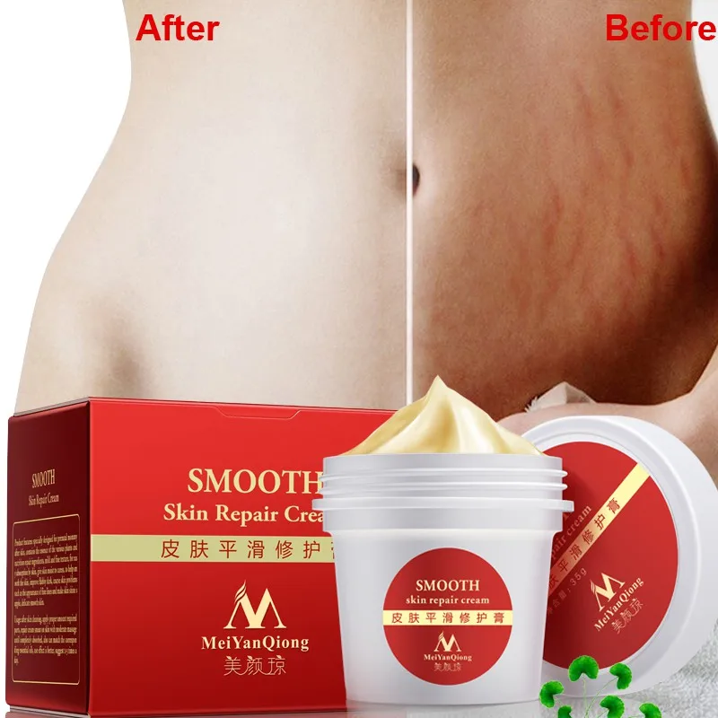 1pc Stretch Marks Removal Cream Skin Repair Cream Body Cream Natural Essence Repair Cream For Pregnancy Maquiagem Makeup 1pc Stretch Marks Removal Cream Skin Repair Cream Body Cream Natural Essence Repair Cream For Pregnancy Maquiagem Makeup