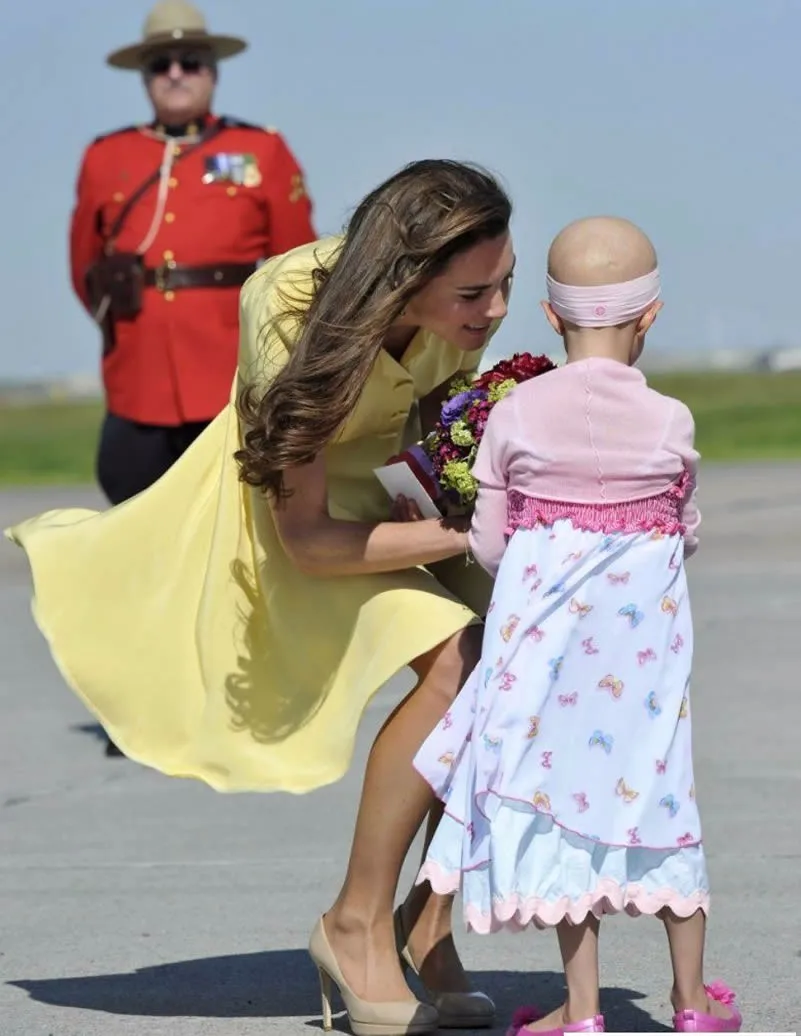 

Yellow Solid Kate Middleton Princess Dres Fashion Button Design Short Sleeve Pleated Dreses