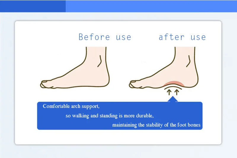 2 пары носочков для ухода при болях облегчающие носки Arch Forefoot Brace анти-износ пять рыхлых носочков противоскользящие пот-невидимые женские ноги-манекен уход