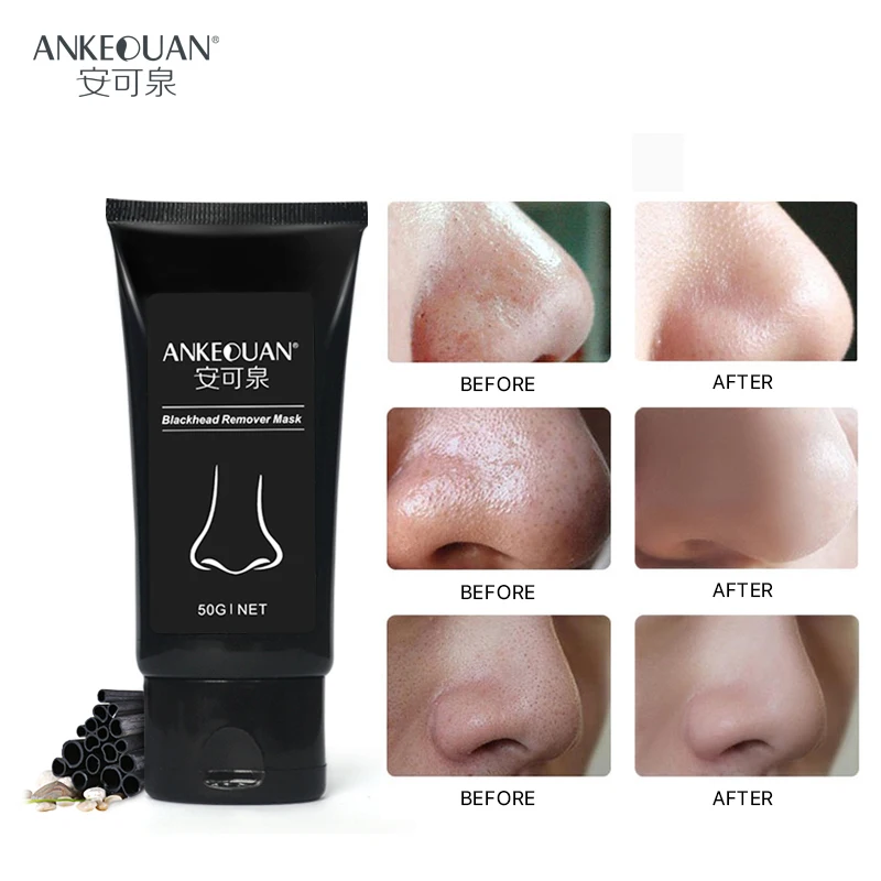 

AUQUEST 100% Plant Blackhead Mask Removal Hyaluronic Acid Deep Cleaning Repair Skin Mask Acne Remove Oil Control Shrink Pores