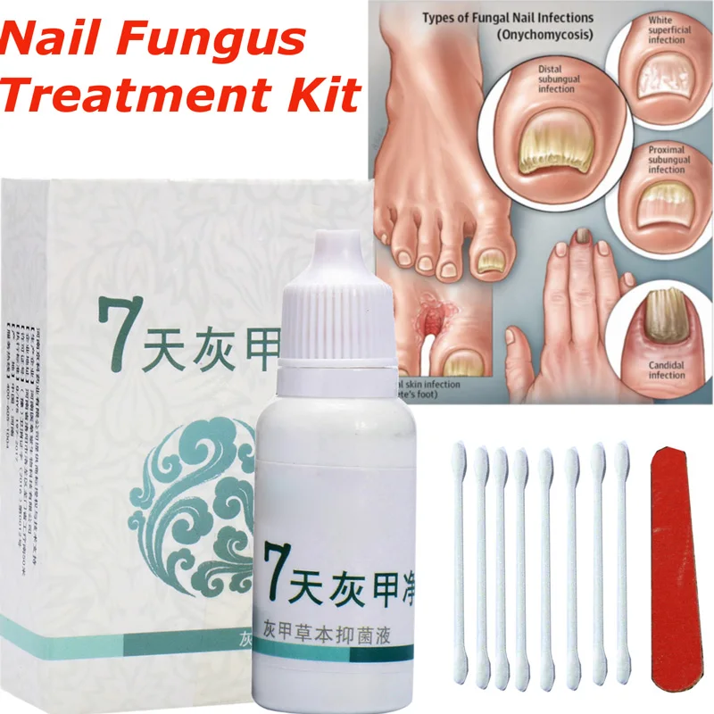 Toe Nail Fungus Treatment Anti Fungal Nail Infection Yellow Essence Removal Care Clear Fungus Nail Cure Treatment