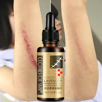 

30g Useful Scar Repair Skin Essential Oil Lavender Skin Care Natural Pure Remove Ance Burn Strentch Marks Scar Removal