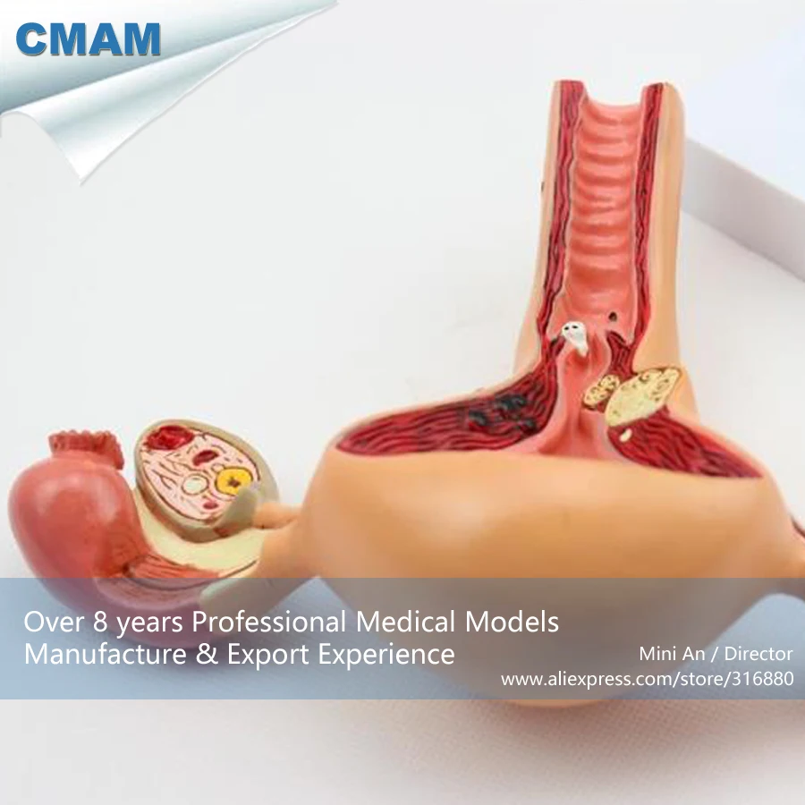 CMAM/12441 патологическое маточное влагалище, мочеполовой медицинский обучение анатомическая модель