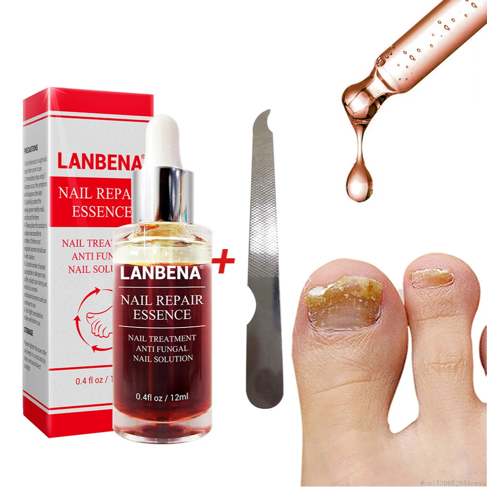 

12ml LANBENA Nail Fungal Treatment with File Nail Repair Nail Treatment Anti Remove Onychomycosis Toe Brighten Nail Care TSLM1