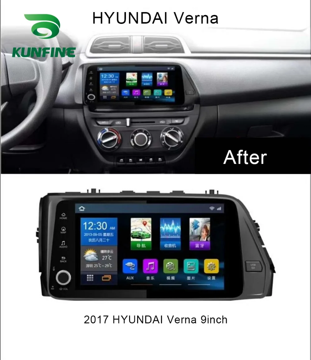 Clearance Octa Core Android 8.1 4GB RAM 64GM ROM Car DVD GPS Navigation Player Deckless Car Stereo for Hyundai Verna 2017 Headunit 1