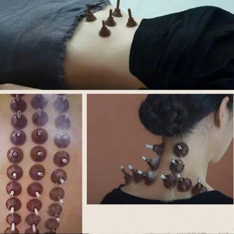 Ладан стержень с полынью для обслуживания свечей и самостоятельной фиксации для прогревания при моксотерапии ai колонны, здравоохранения