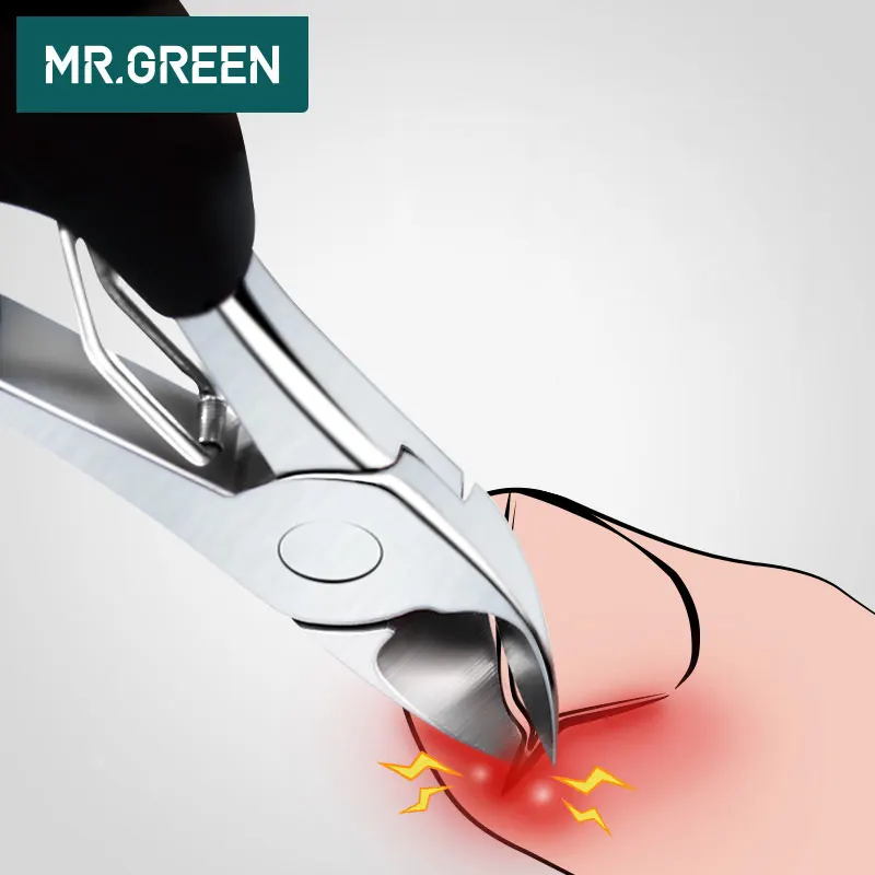 

MR.GREEN ingrown and thick Toenails tool Nail Clippers Professional Stainless Steel Manicure sharp Trimmer Pliers Cutter