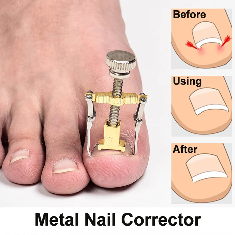 Педикюрный корректор для ногтей Podiatrist инструменты маникюра лечения завитков