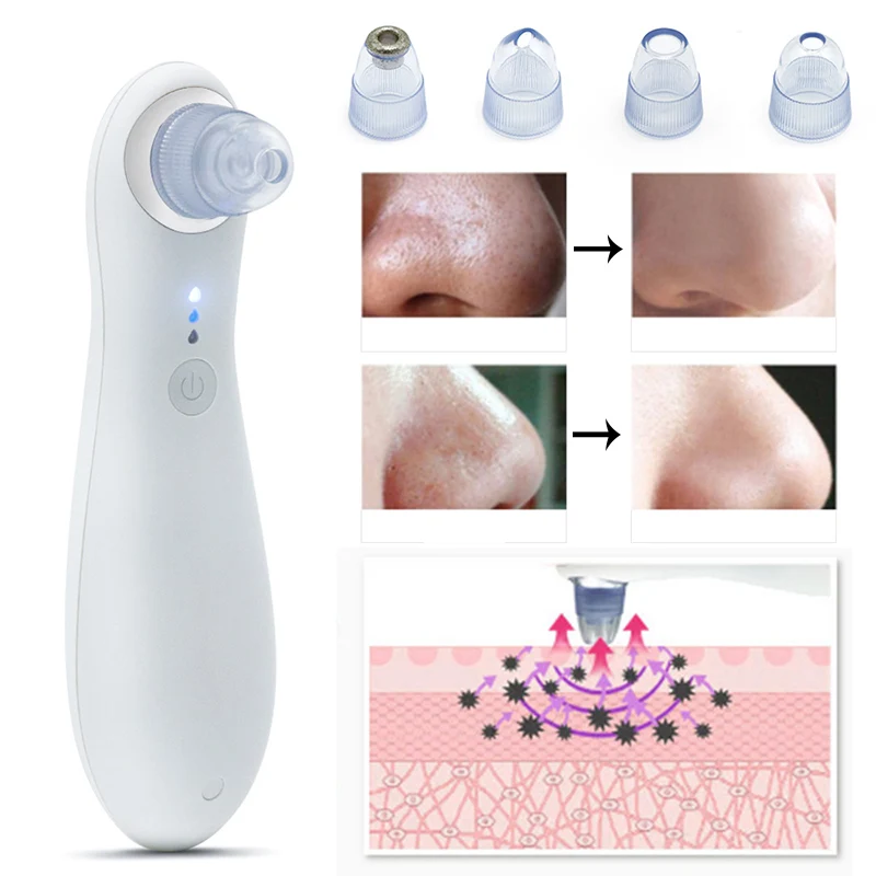 Blackhead Remover Suction Pore Vacuum Cleaner Black Dots Removal Tool Comedo Remover Blackhead Extractor Face Exfoliator Device