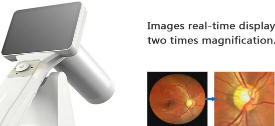  Portable Handheld Non Mydriatic Fundus Camera With FDA Free Shipping