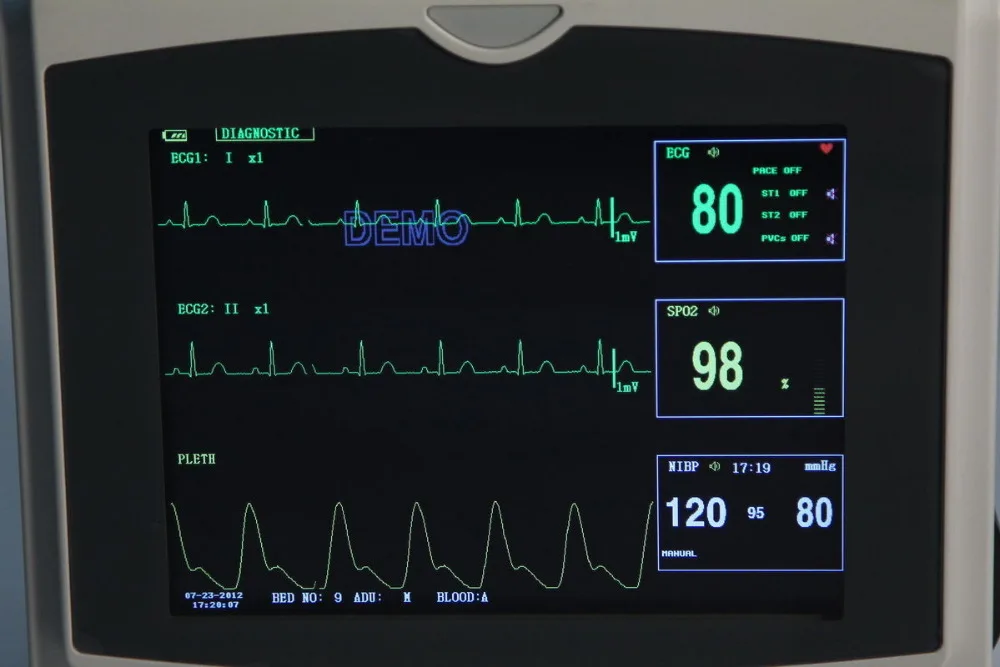 CONTEC CMS6000C ICU жизненные знаки 4 параметра монитор пациента ЭКГ, NIBP, Spo2, PR