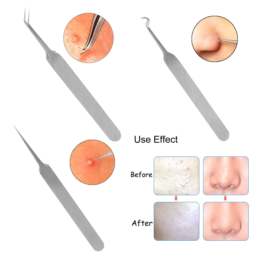 3 шт./компл. игольчатый Пинцет для прыщей пятна угорь, прыщ, акне удаления острым изгиб экстрактор Нержавеющая сталь уход за кожей лица Уход