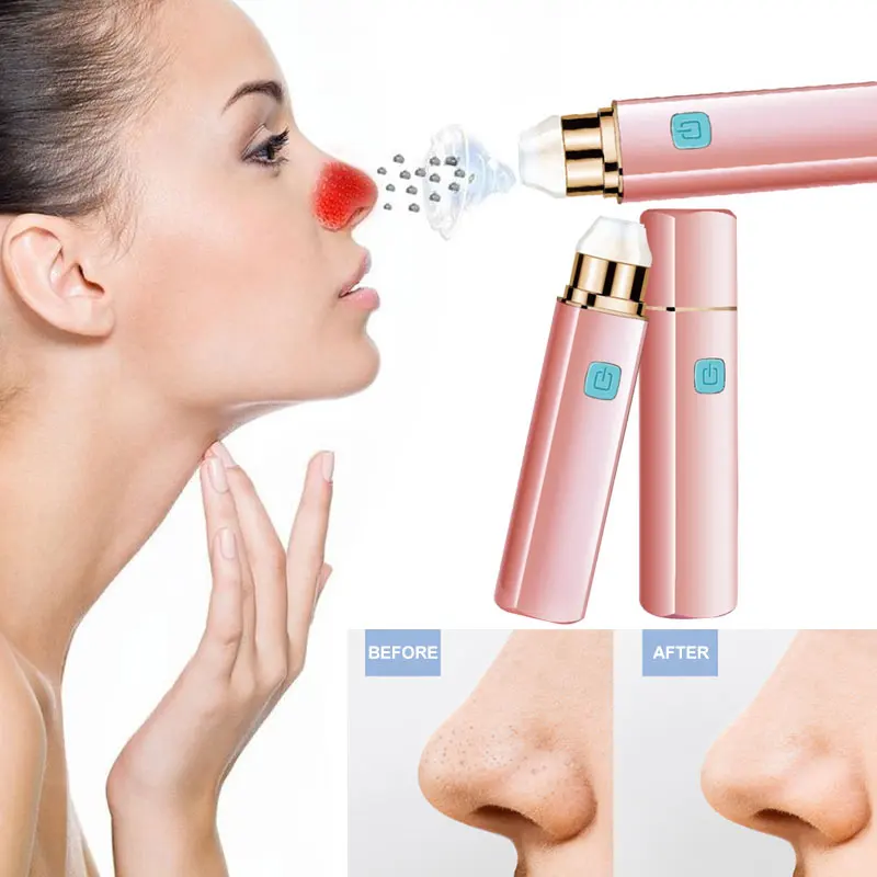 

Nose Pore Remover Vacuum Acne Cleanser Lipstick Pink Effective Strength Facial Skin Care Fashion Cosmetic Instrument