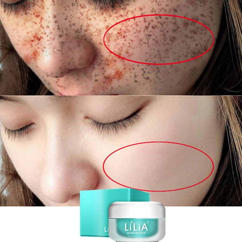 anti aging moisturizing cream