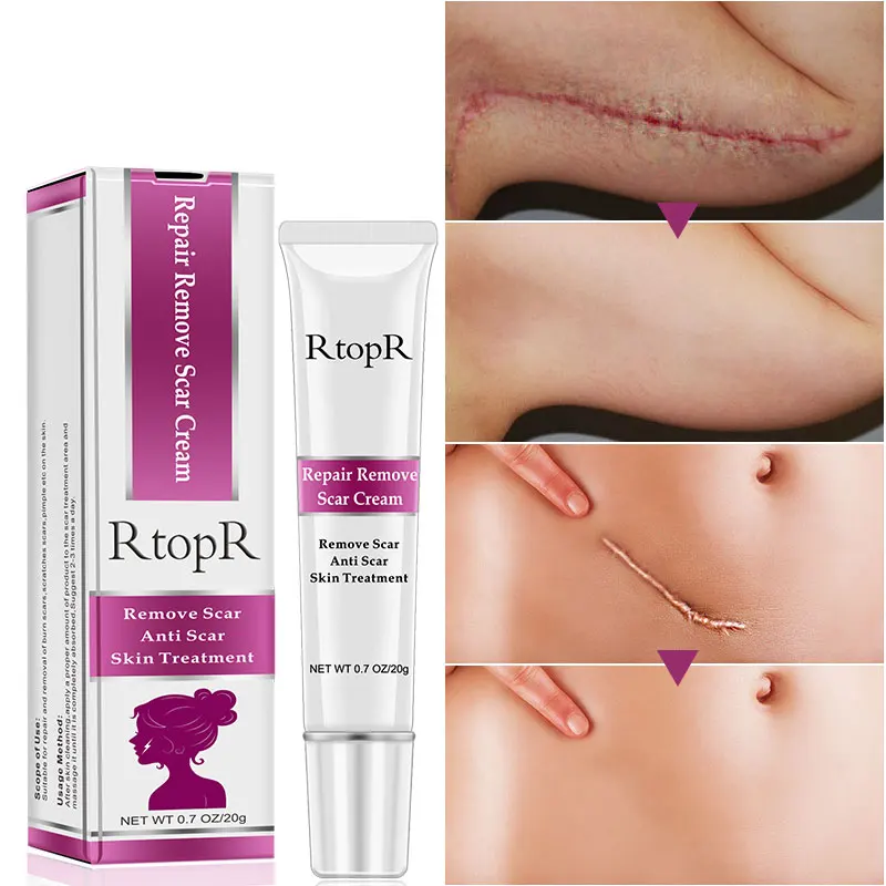 

RtopR Acne Scar Stretch Marks Remover Cream Skin Repair Face Cream Acne Spots Acne Treatment Blackhead Whitening Cream Skin Care