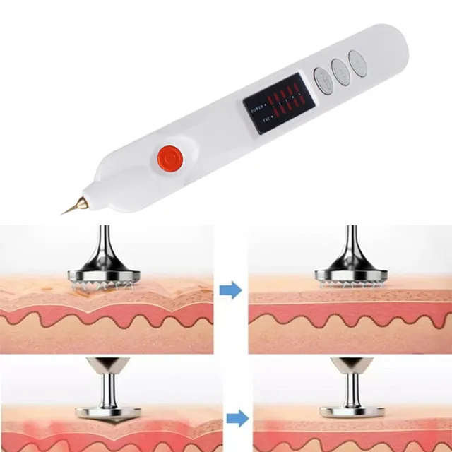 Face-Skin-Dark-Spot-Remover-Laser-Plasma-Pen-Skin-Firming-Skin-Care-Mole-Tattoo-Removal-Machine.jpg_640x640