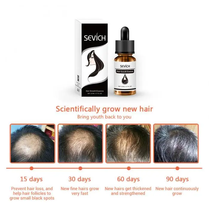 Sevich средство для роста волос масло быстрое мощное жидкое Лечение Эфирное масло для ухода за волосами OR88
