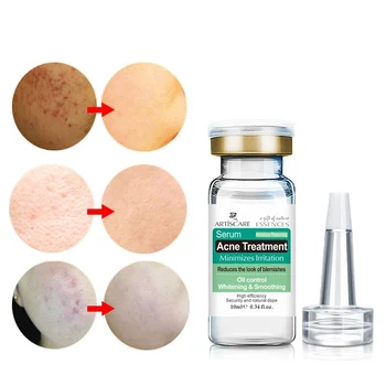 

Anti Acne Essence Serum Acne Treatment Blackhead Whitening Shrink Pores Moisturizer Hyaluronic Acid Pregnant Women's Eye Essence