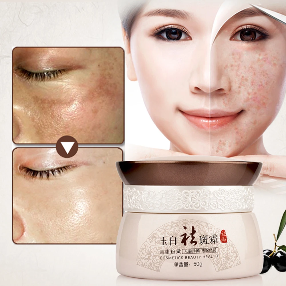 MQ-Skin-Brightening-Freckle-Cream-Face-Melasma-Treatment-Diminishing-Skin-Sunburn-Yellowish-Removal-of-Hyperpigmentation