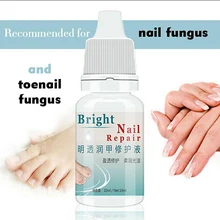 1 шт. блеск для ускорения метаболизма ногтей грибок для удаления онихомикоза жидкое средство для восстановления пальцев 10 мл