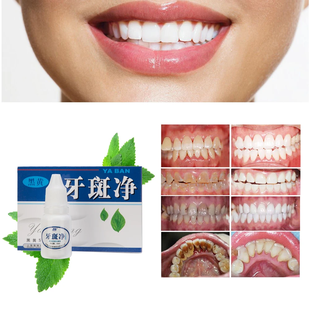 

10ml Teeth Whitening Dental Bleaching Liquid Oral Hygiene Cleaning Magic Water Smoke Stain Remove