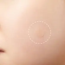 Лечение прыщей 24 патча прыщи лечение акне прыщи мастер патч 24 патчи прыщи лечение дропшиппинг