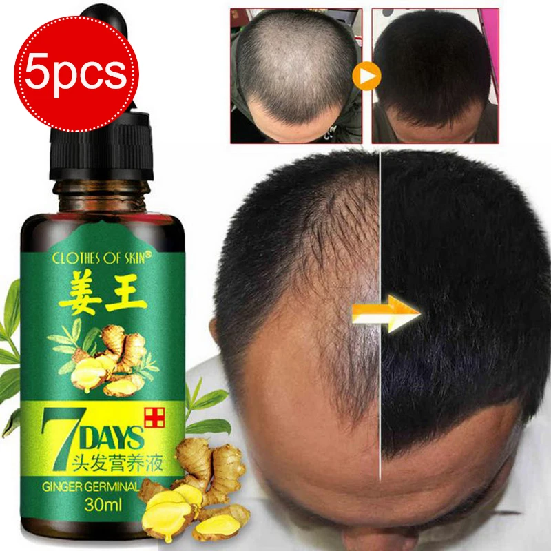 

5pcs/set Hair Growth Essence Hairs Loss Liquid Pure Original Essential Oils Dense Hairs Growth Serum Hair Repair Growing Faster