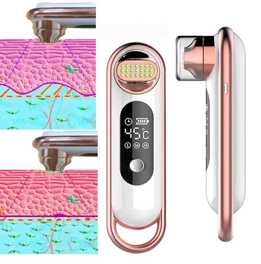 

RF Lifting Skin Wrinkle Removal Beauty Machine Dot Matrix Facial Radio Frequency Face Lifting Skin Tighten