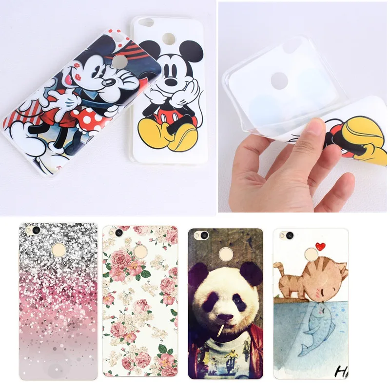 

For Xiaomi Redmi Note 4 Case Protective TPU Back Cover For Xiaomi Mi A1 Max 2 Redmi 4a 4x 5a Note 4 Ultra Thin Slim Coque Fundas
