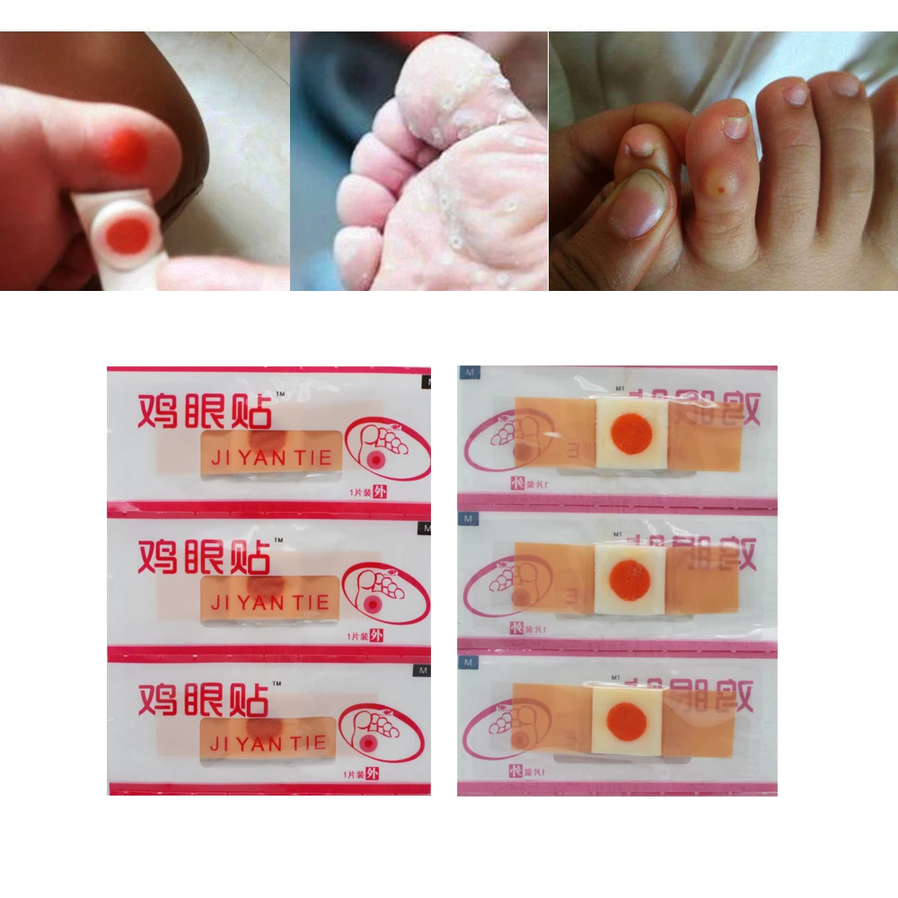 

60pcs/lot Medical Corn Patch Foot Callus Remove 100% Useful Exfoliating Foot Paste Corn Remove Dead Skin Repair Pain Feet D011