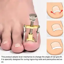 2 шт. вросших ногтей ног устройство фиксации для педикюра ногти восстановить коррекции ногтей инструмент корректор для ногтей инструмент