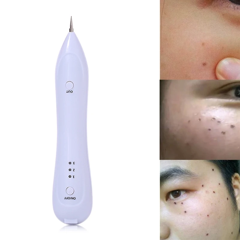 10-240 В Татуировка точка моль удаление веснушек плазменная ручка ...