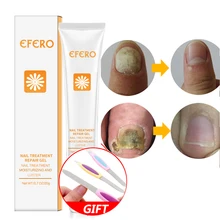 EFERO грибок для восстановления ногтей эссенция Сыворотка для лечения Ногтей удаляет онихомикоз ногти и пальцы ног отбеливание ногтей Уход за кожей 20 г