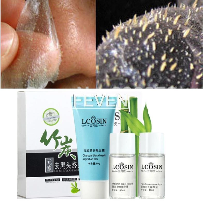 best cream for acne for men