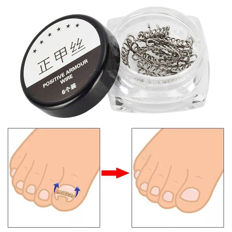 

1 Box Ingrown Toe Nail Correction Wire Fixer Pedicure Paronychia Recover Toenails Corrector Correction Stickers Foot Care Tool