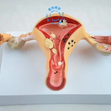 И патологическая модель матки, анатомия матки, модель дисекта гениталий, обучение для медицинских