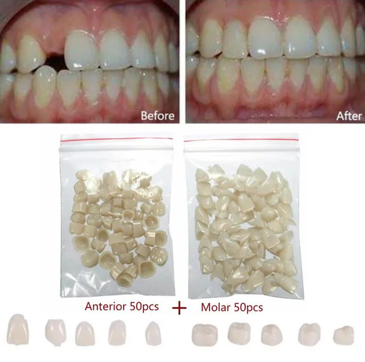 2 упаковки стоматологических материалов смешанные временные короны задние виниры зубы стоматолога продукты Отбеливание зубов поддельные зубы поставки