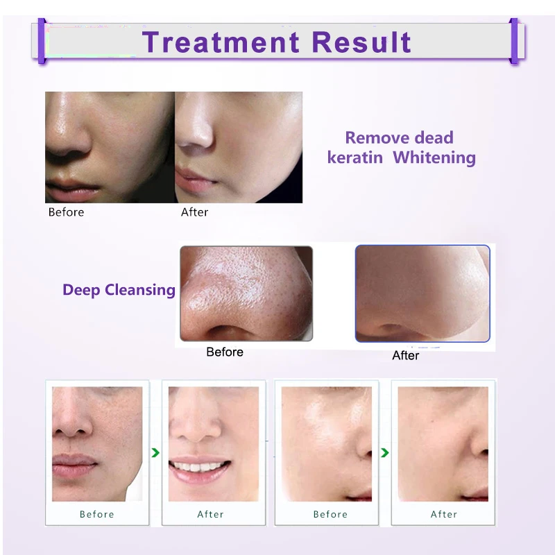 Treatmen effect