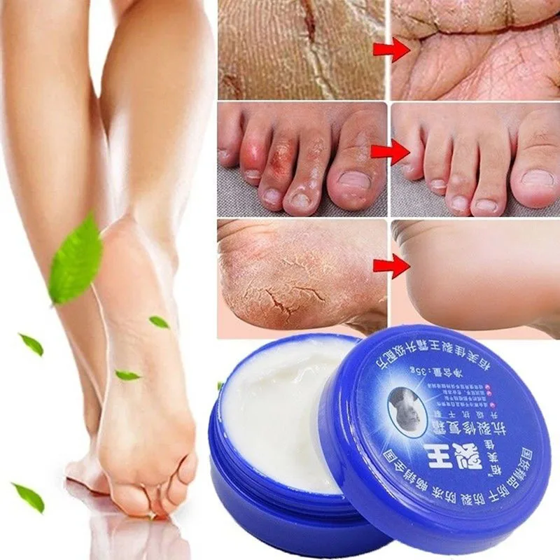 

1pc Traditional Chinese Balm Exfoliating Hand Foot Crack Cream Heel Chapped Peeling Feet Hand Repair Anti Dry Crack Skin Care