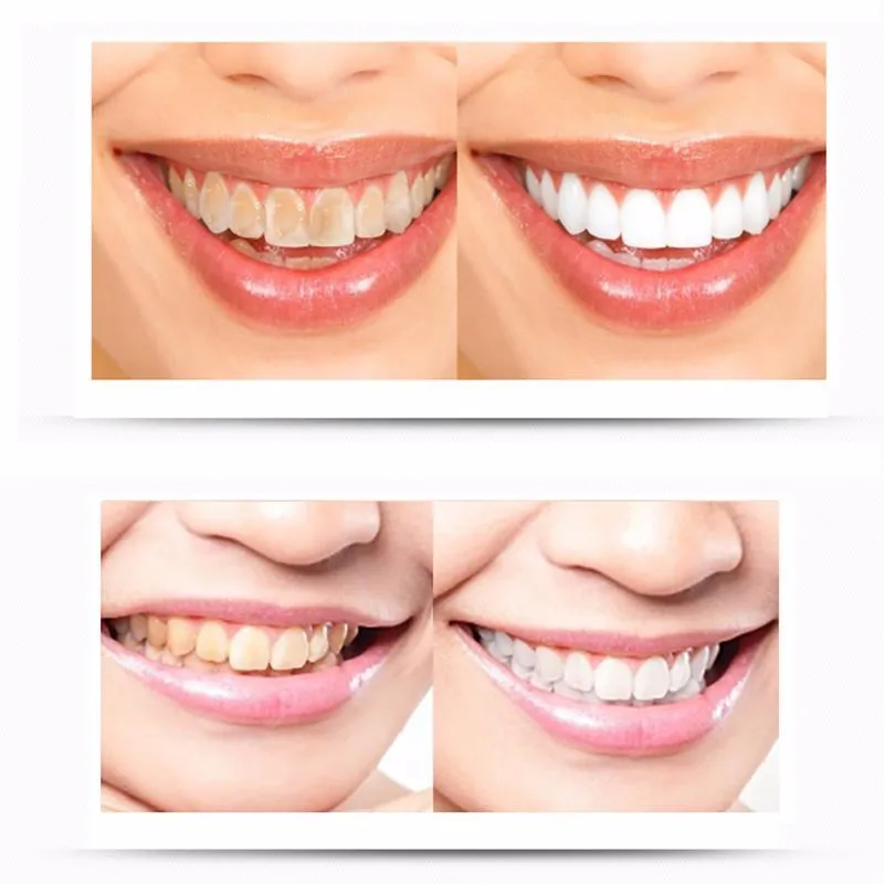 BTG est креативный эффективный высокопрочный гель для отбеливания зубов с прозрачными белыми зубами, отбеливатель для зубов, PH нейтральный