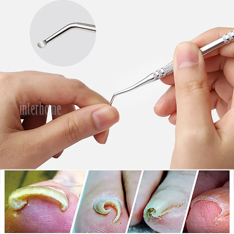 Nail-Clipper-Bar(10)