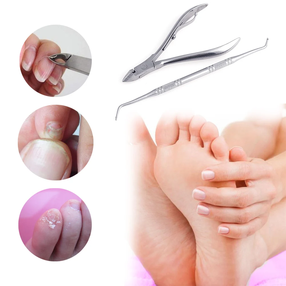 

2Pcs/Set Manicure Pedicure Tools Ingrown Toe Nail Correction Cuticle Pusher Dead Skin Dirt Remover Nail Nipper Cutter Foot Care